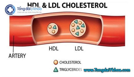 LDL được coi là cholesterol “xấu”, HDL được coi là cholesterol “tốt”
