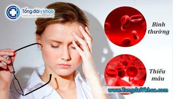 Thiếu máu xảy ra khi số lượng hồng cầu lưu thông trong cơ thể giảm. Các triệu chứng có thể bao gồm đau đầu, đau ngực và da nhợt nhạt…