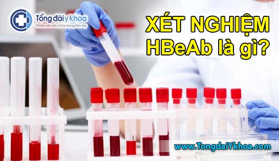 xét nghiệm HBeAb là gì xét nghiệm viêm gan B